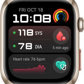 Huawei Watch D2 Aluminium 48mm με Παλμογράφο (Χρυσό)