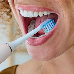 Philips Sonicare C3 Premium Plaque Defence Ανταλλακτικές Κεφαλές για Ηλεκτρική Οδοντόβουρτσα HX9044/87 4τμχ