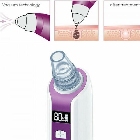 Beurer FC 41 Συσκευή Καθαρισμού Προσώπου από Μαύρα Στίγματα